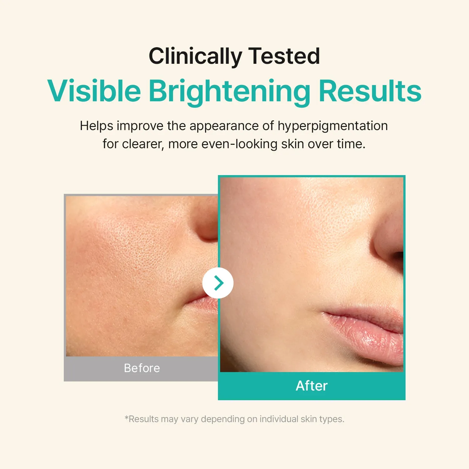Acwell Licorice pH Balancing Advanced Facial Serum Ampoule serum